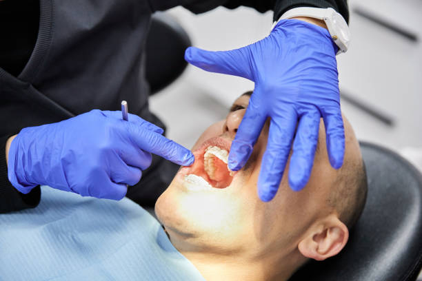Best Emergency Wisdom Teeth Removal in Chesterbrook, PA